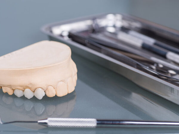 The Best Dental Crown Care Advice: How To Keep Your Crown Looking Excellent