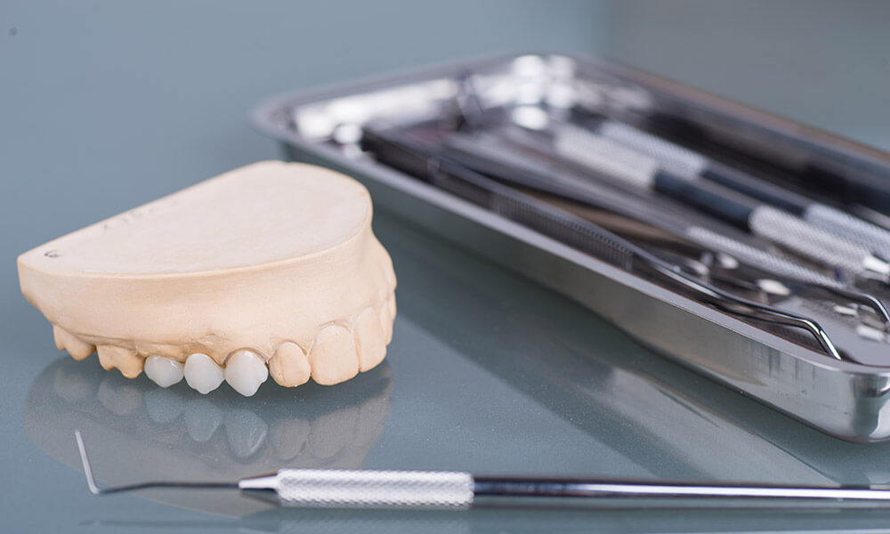 The Best Dental Crown Care Advice: How To Keep Your Crown Looking Excellent