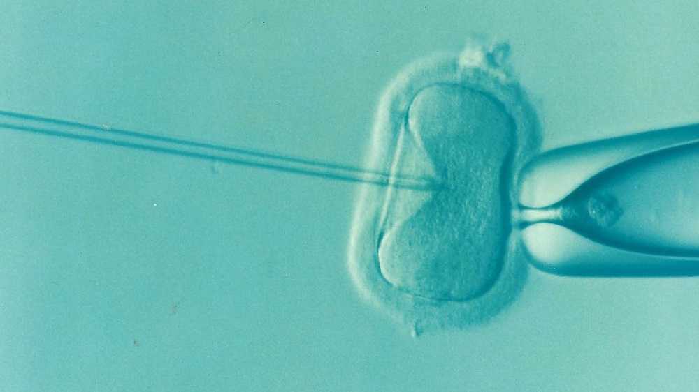 From Conception to Delivery: Harnessing the Magic of Cutting-Edge IVF Technology for Safe and Effective Care