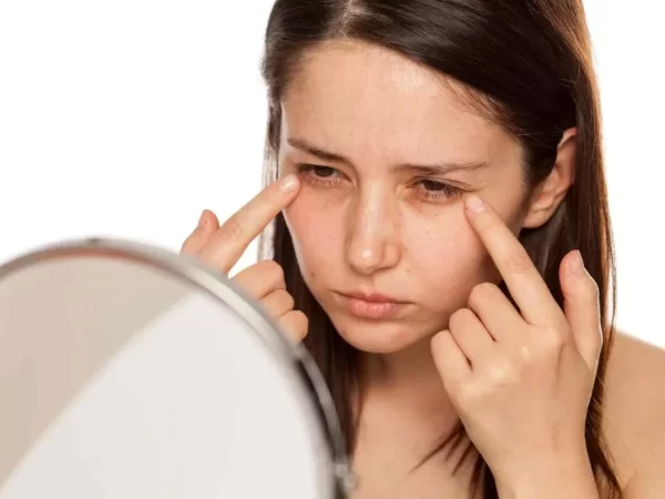 The Mystery Behind Dark Eye Circles: Causes and Solutions