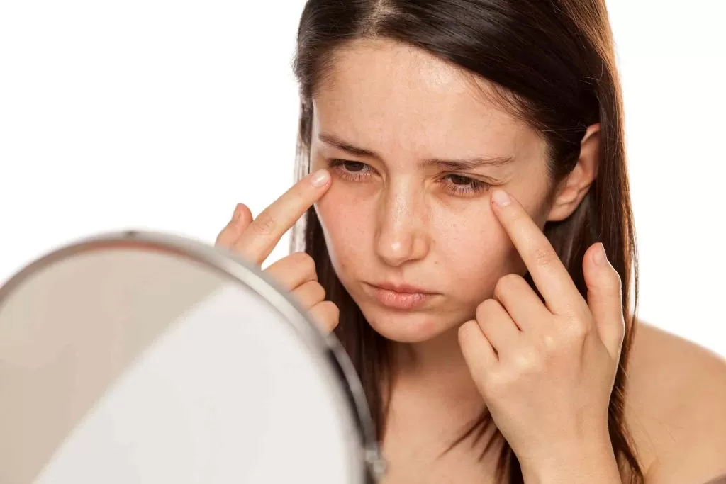 The Mystery Behind Dark Eye Circles: Causes and Solutions