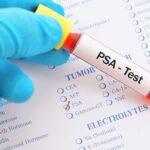 The Best PSA Tests With Its Types