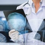 Essential Tips for Optimizing Brain Health Care in Southern California