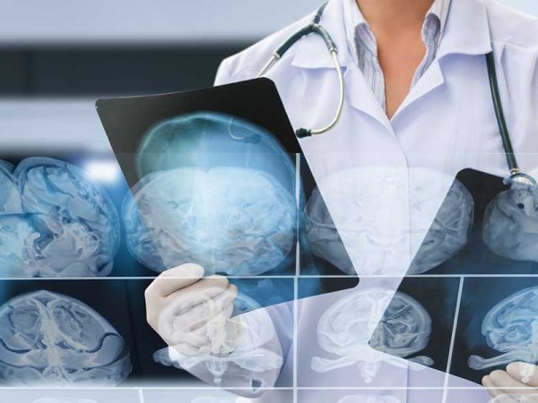 Essential Tips for Optimizing Brain Health Care in Southern California