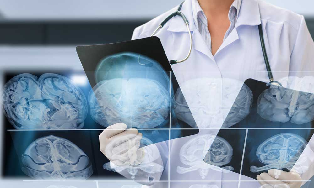 Essential Tips for Optimizing Brain Health Care in Southern California