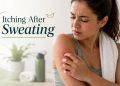 itching after sweating