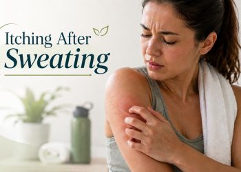itching after sweating