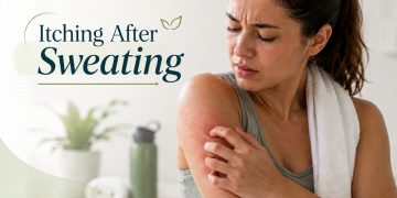 itching after sweating