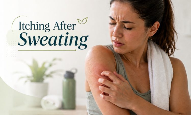 itching after sweating
