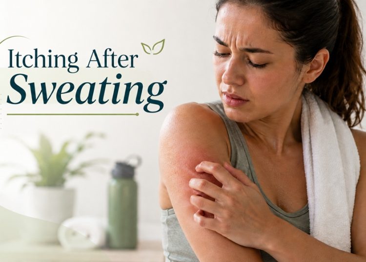 itching after sweating